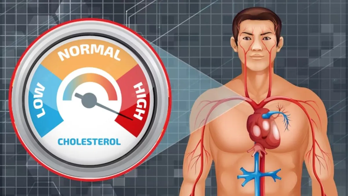 cholesterol